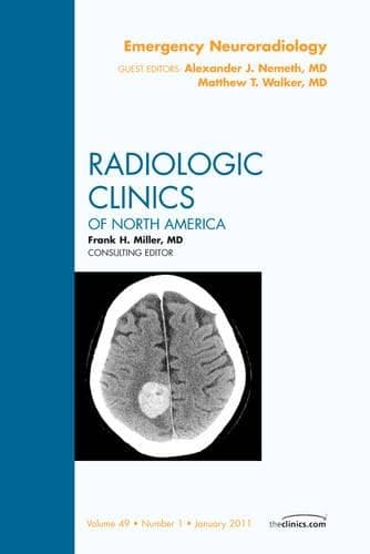 Cover of Emergency Neuroradiology, An Issue of Radiologic Clinics of North America: Volume 49-1(Volume 49-1 The Clinics: Radiology)
