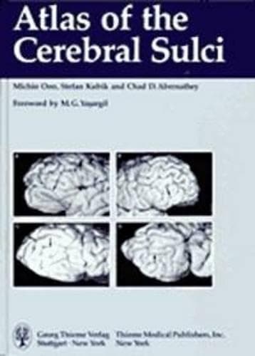 Cover of Atlas of the Cerebral Sulci