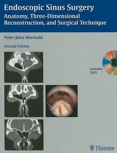 Cover of Endoscopic Sinus Surgery