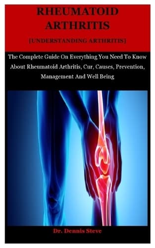 Cover of Rheumatoid Arthritis [Understanding Arthritis]