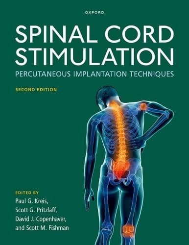 Cover of Spinal Cord Stimulation