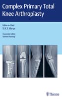 Cover of Complex Primary Total Knee Arthroplasty