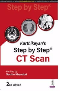 Cover of Karthikeyan's Step by Step CT Scan, 2nd Edition, Revised by Sachin Khanduri
