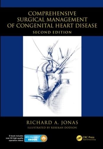 Cover of Comprehensive Surgical Management of Congenital Heart Disease