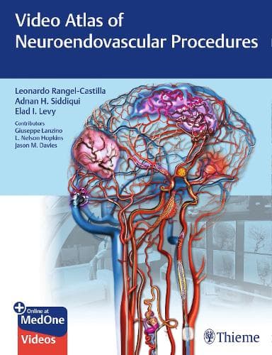 Cover of Video Atlas of Neuroendovascular Procedures