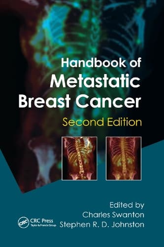 Cover of Handbook of Metastatic Breast Cancer