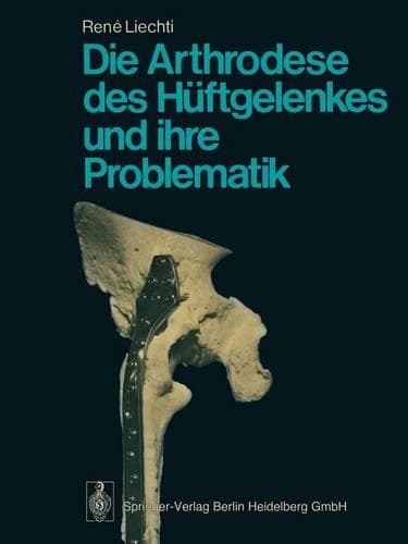 Cover of Die Arthrodese des Hüftgelenkes und ihre Problematik