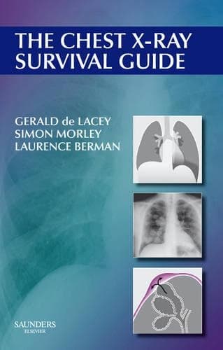 Cover of The Chest X-ray Survival Guide