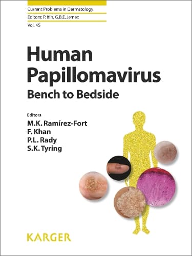 Cover of Human Papillomavirus