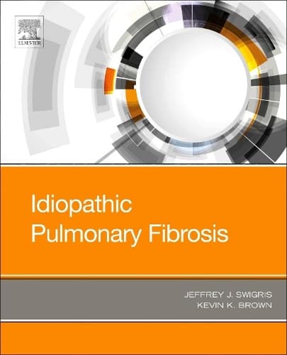 Cover of Idiopathic Pulmonary Fibrosis