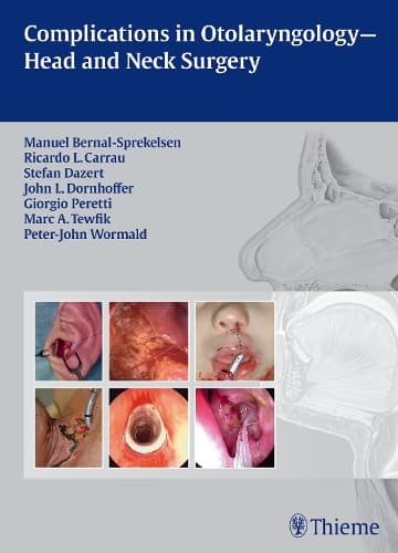 Cover of Complications in Otolaryngology - Head and Neck Surgery