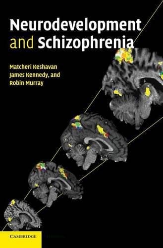 Cover of Neurodevelopment and Schizophrenia: (English)