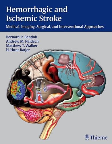 Cover of Hemorrhagic and Ischemic Stroke
