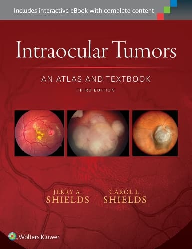 Cover of Intraocular Tumors: An Atlas and Textbook