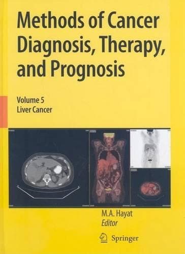 Cover of Liver Cancer