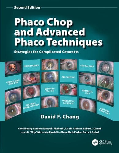 Cover of Phaco Chop and Advanced Phaco Techniques
