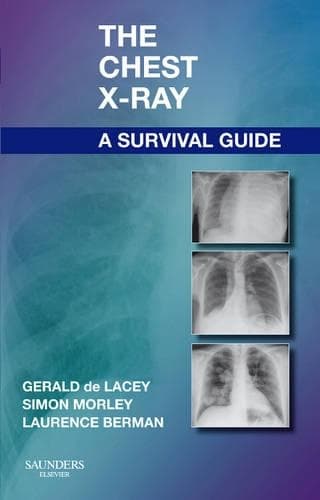 Cover of The Chest X-Ray: A Survival Guide