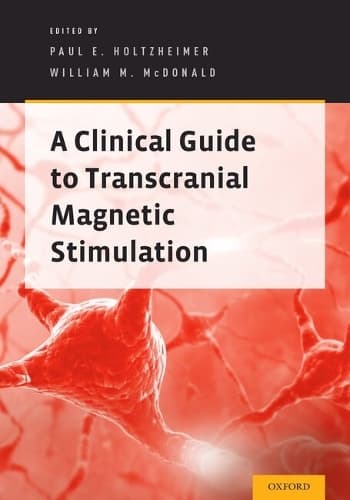 Cover of A Clinical Guide to Transcranial Magnetic Stimulation: (English)