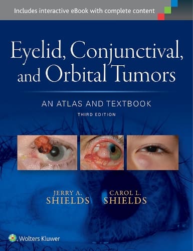 Cover of Eyelid, Conjunctival, and Orbital Tumors: An Atlas and Textbook