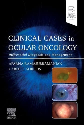 Cover of Clinical Cases in Ocular Oncology