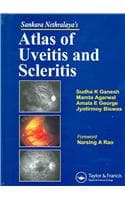 Cover of Sankara Nethralaya's Atlas of Uveitis and Scleritis