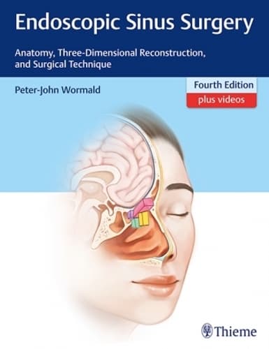 Cover of Endoscopic Sinus Surgery