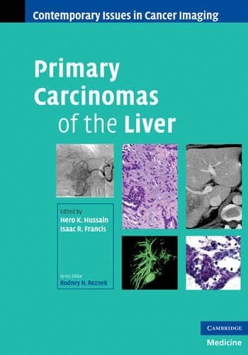 Cover of Primary Carcinomas of the Liver