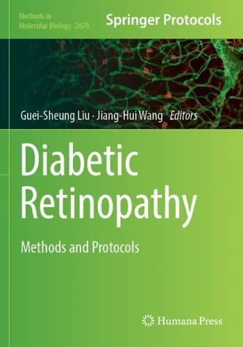 Cover of Diabetic Retinopathy