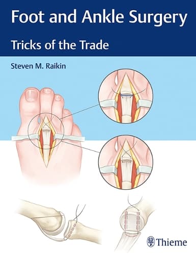 Cover of Foot and Ankle Surgery