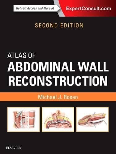 Cover of Atlas of Abdominal Wall Reconstruction