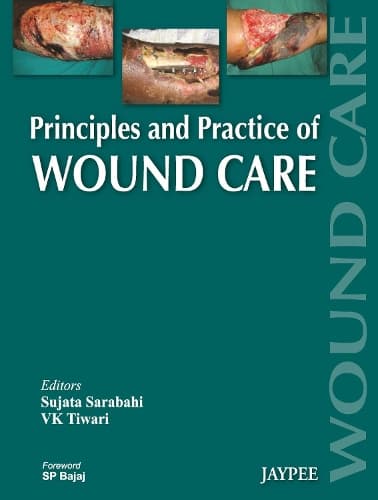 Cover of Principles and Practice Of Wound Care