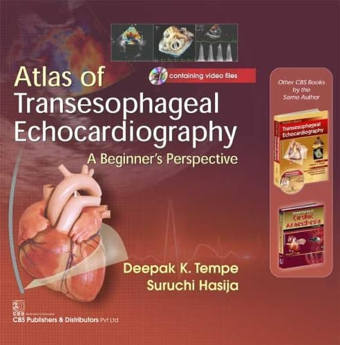 Cover of Atlas of Transesophageal Echocardiography