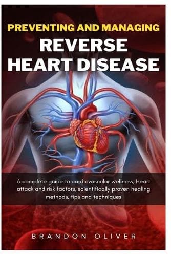 Cover of Preventing And Managing Reverse Heart Disease