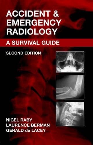 Cover of Accident and Emergency Radiology