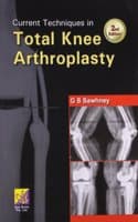 Cover of Current Techniques in Total Knee Arthroscopy, 2/e