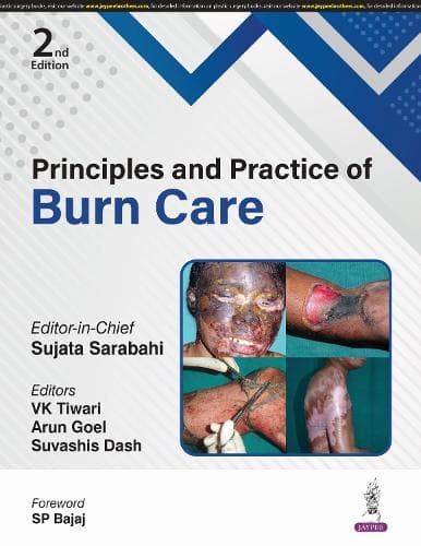 Cover of Principles and Practice of Burn Care