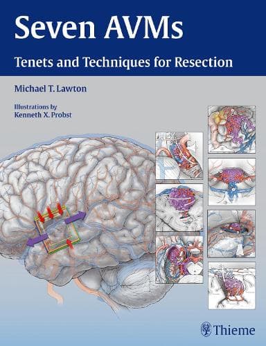 Cover of Seven AVMs