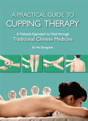 Cover of Practical Guide to Cupping Therapy