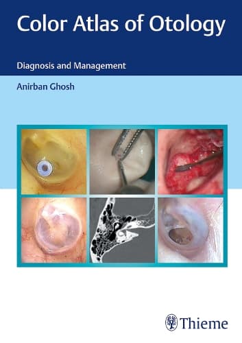 Cover of Color Atlas of Otology