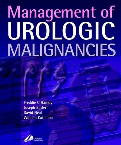 Cover of Management of Urologic Malignancies