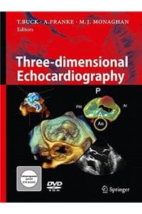 Cover of Three-dimensional Echocardiography