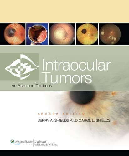 Cover of Intraocular Tumors