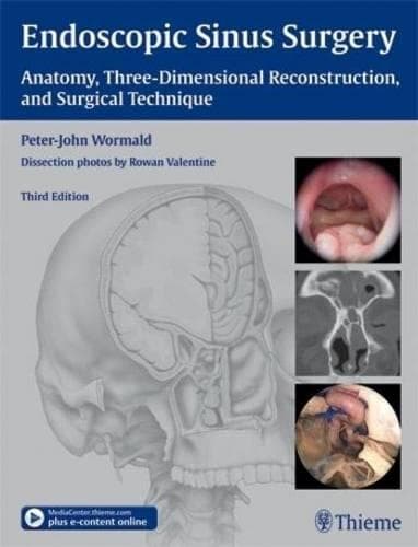 Cover of Endoscopic Sinus Surgery