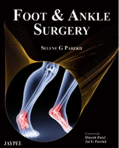 Cover of Foot and Ankle Surgery