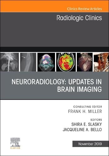 Cover of Neuroradiology, an Issue of Radiologic Clinics of North America