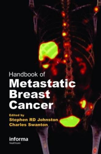 Cover of Handbook of Metastatic Breast Cancer