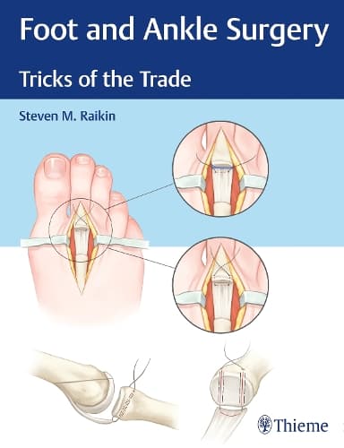 Cover of Foot and Ankle Surgery