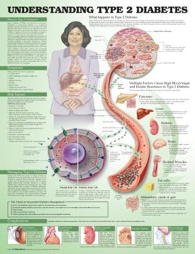 Cover of Understanding Type 2 Diabetes Anatomical Chart