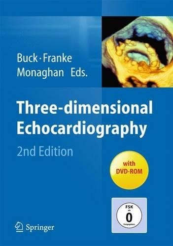 Cover of Three-dimensional Echocardiography